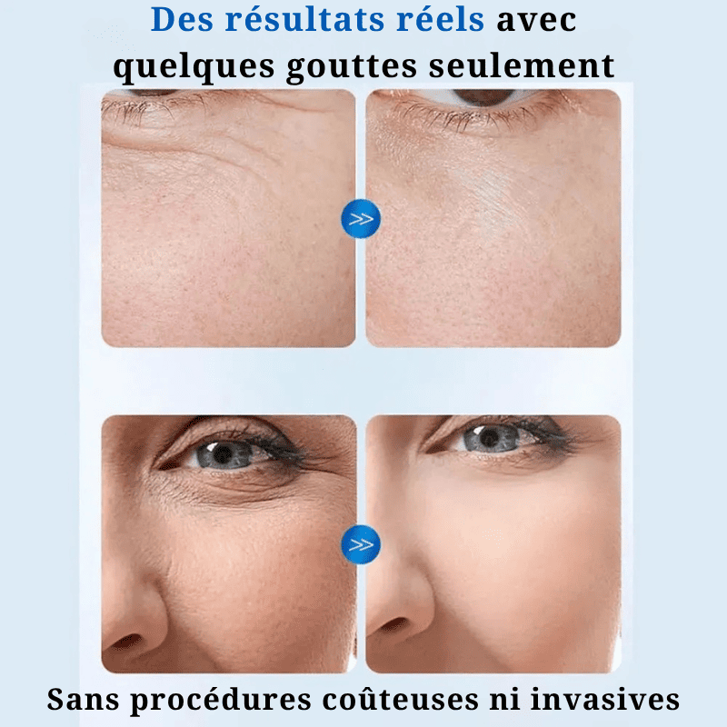 Sérum à l’Acide Hyaluronique en Gouttes